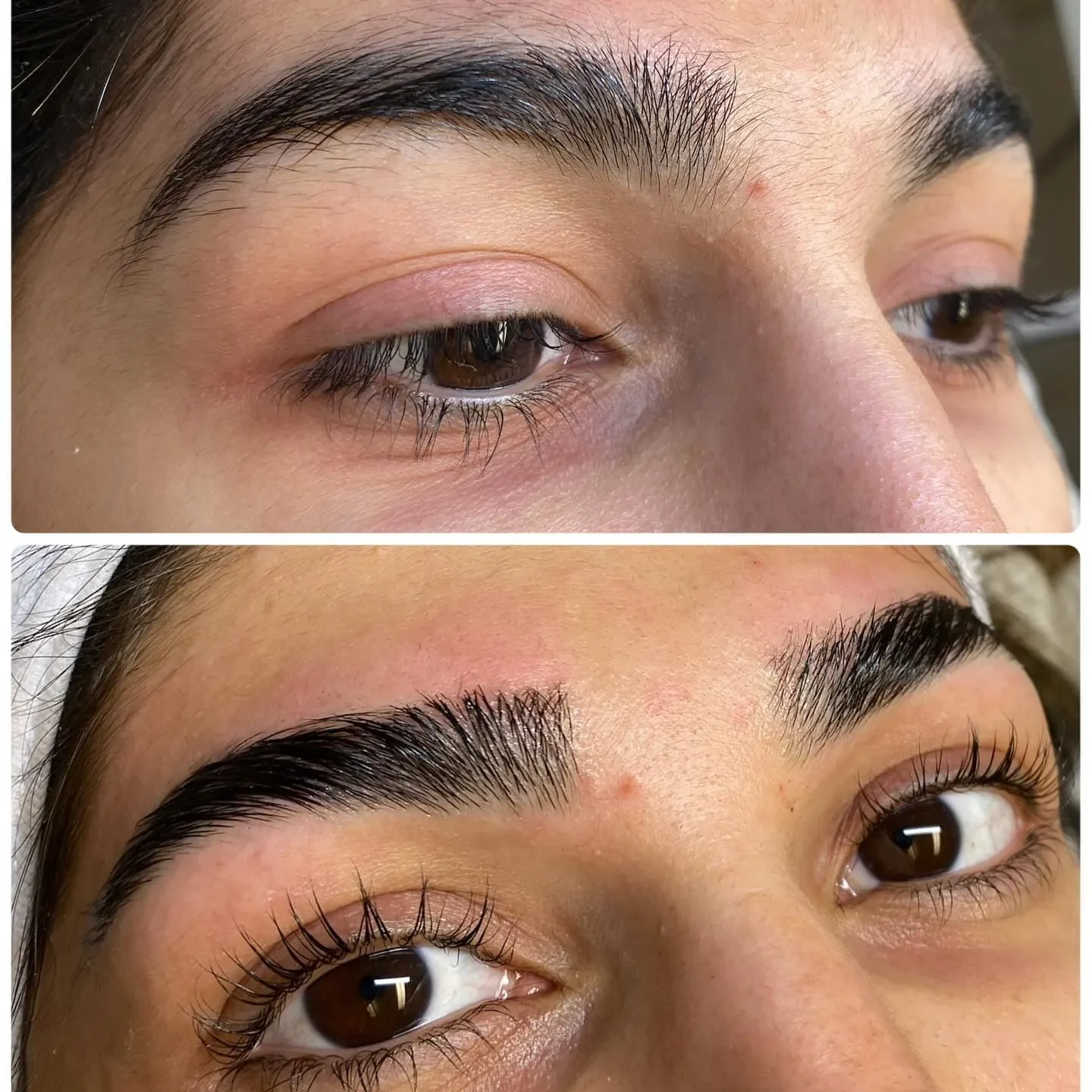 Exempel på Microneedling utfört av företaget – Sandy’s Skönhetssalong